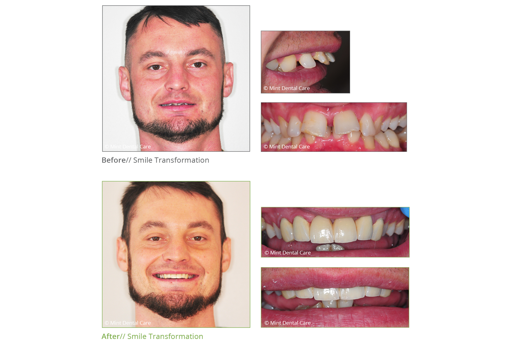 Smile Transformation Skegness